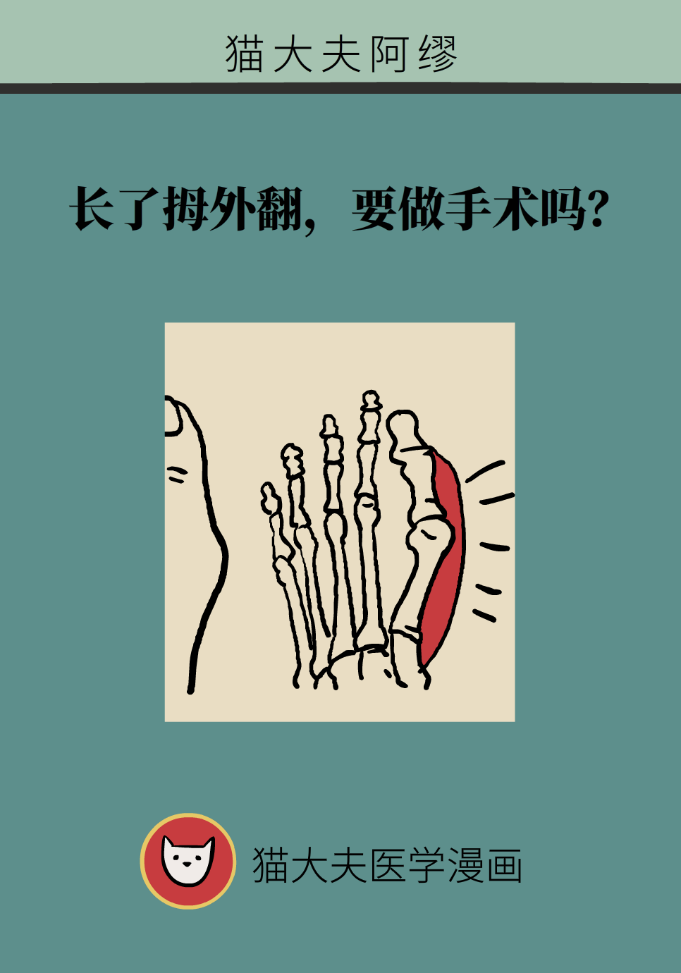 拇指外翻要做手术吗？这6种方法值得学习